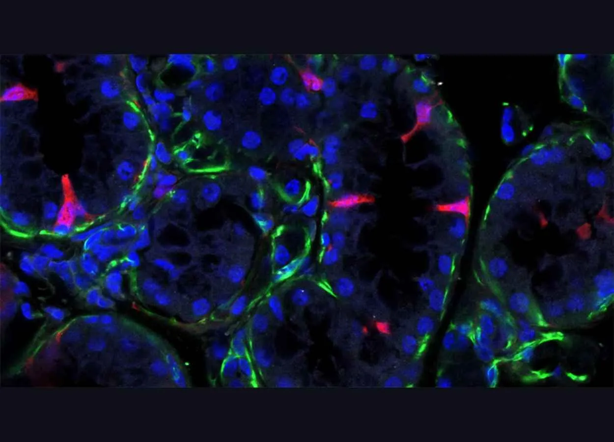 Newly identified cell type could be the key to restoring damaged salivary glands