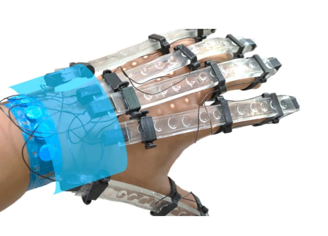 3D Printed Gloves for Rehabilitating Stroke Patients