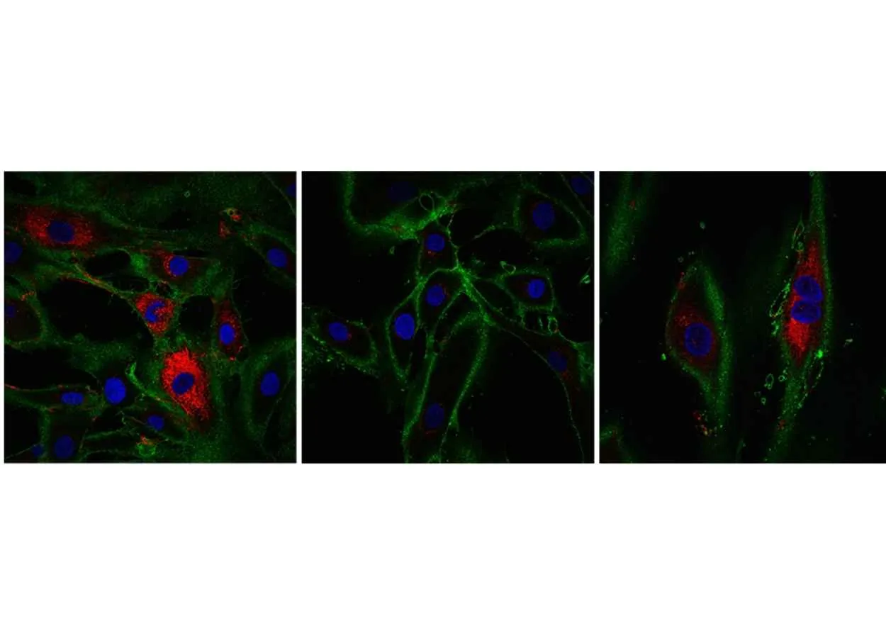 A jump through time – new technique rewinds the age of skin cells by 30 years