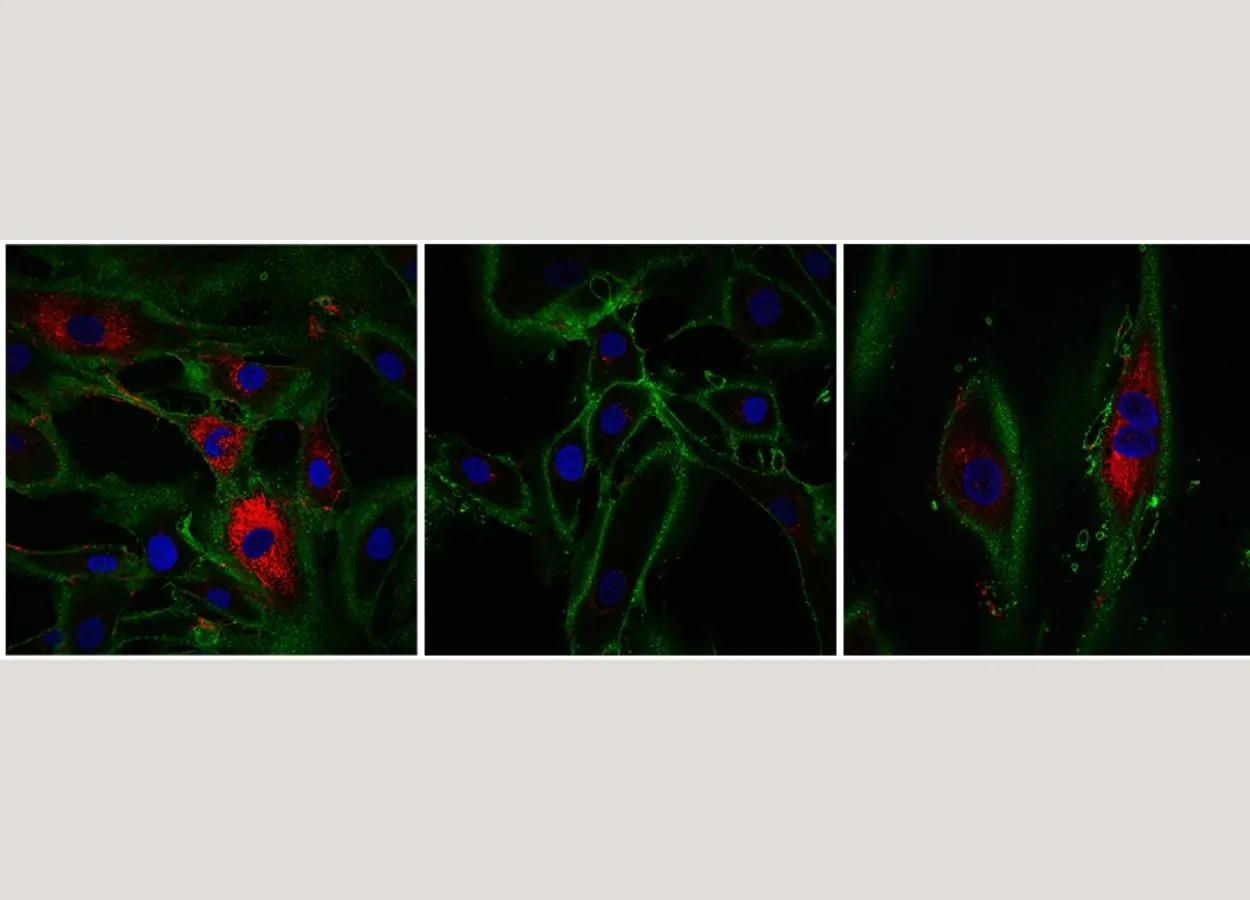 A jump through time – new technique rewinds the age of skin cells by 30 years