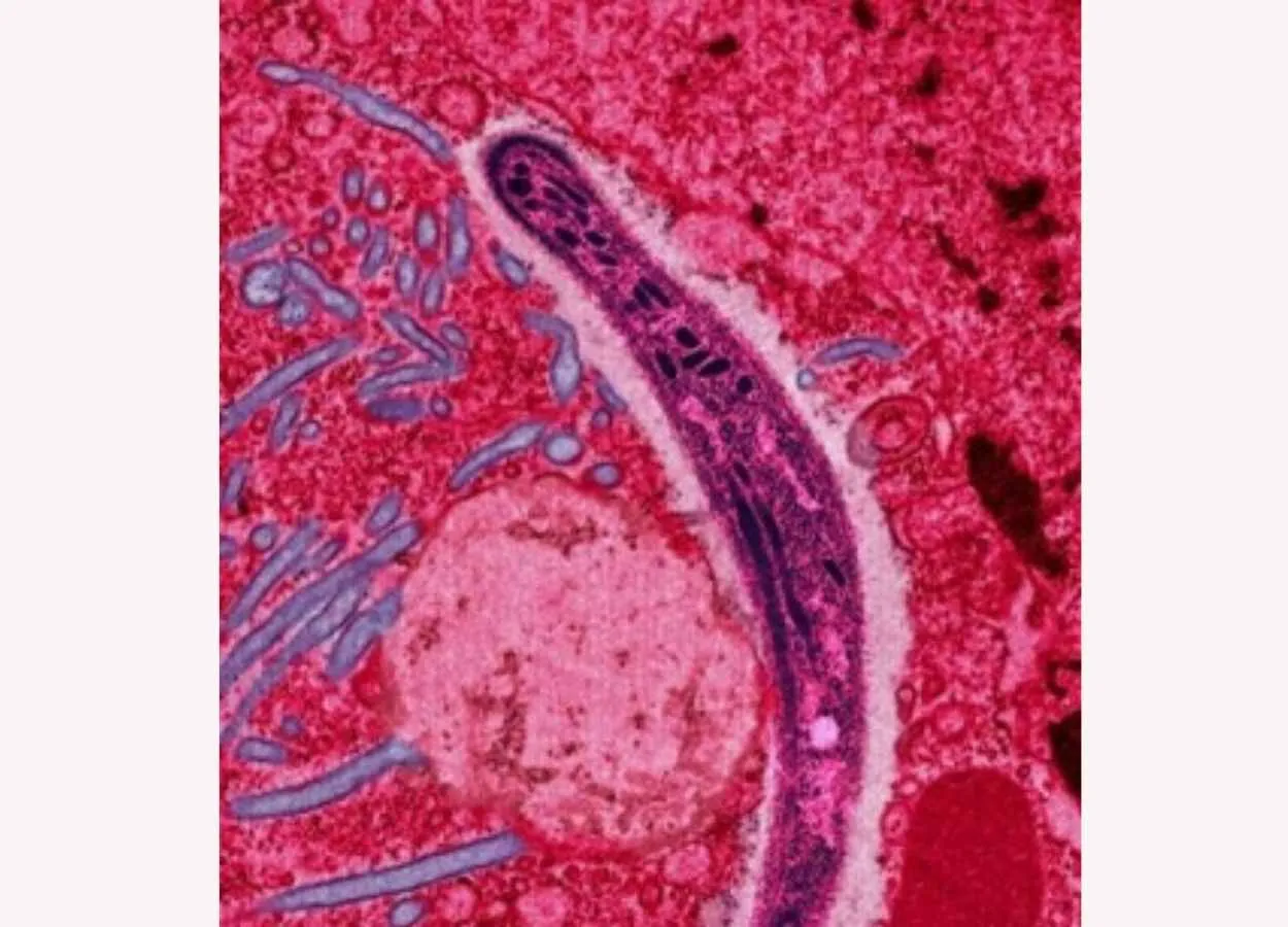Why vaccination against malaria quickly loses its protective effect