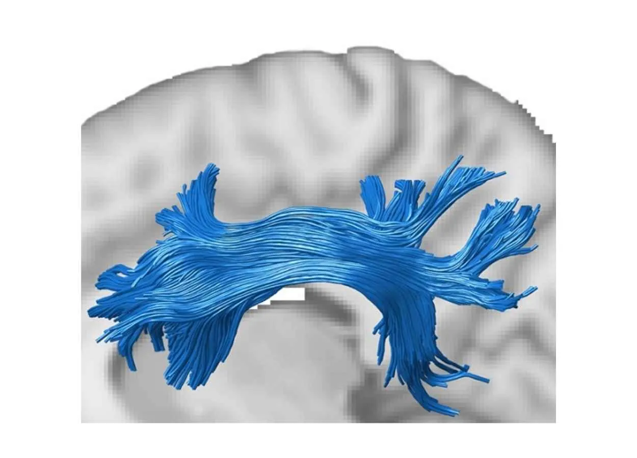 Study could help better management of Alzheimer’s patients 