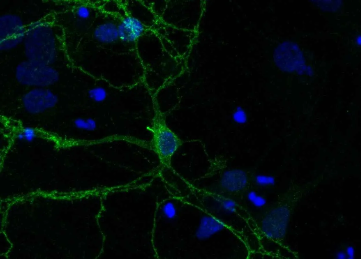 A role for cell antennae in managing dopamine signals in the brain