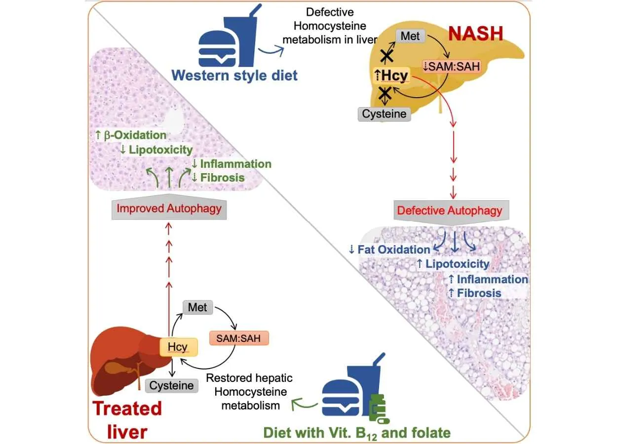 B vitamins can potentially be used to treat advanced non-alcoholic fatty liver disease : Scientists