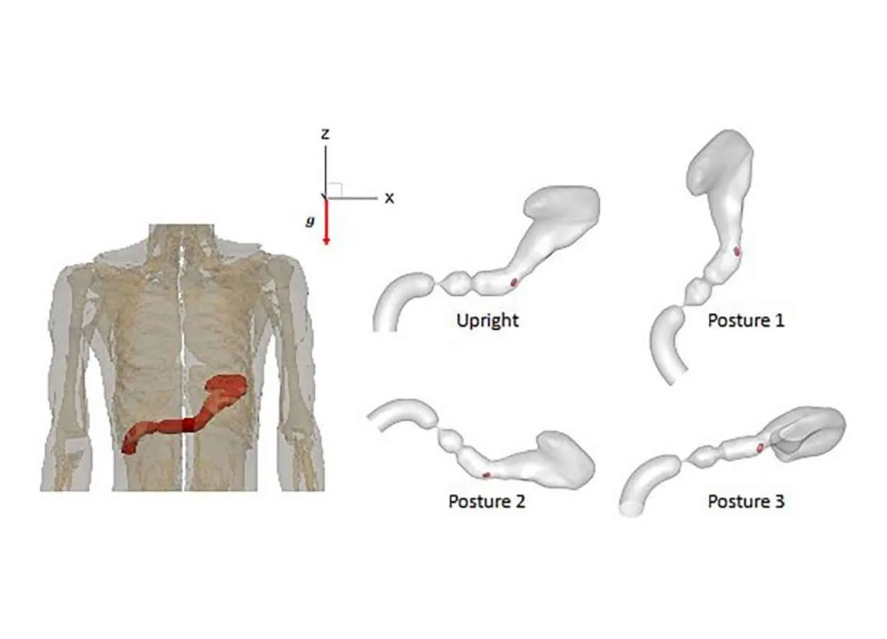 Body Posture Affects How Oral Drugs Absorbed by Stomach
