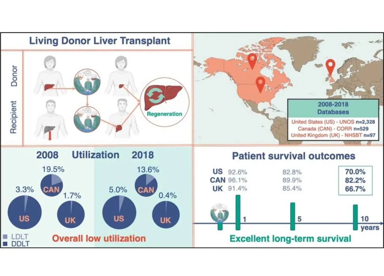 Living donor transplantation offers a safe alternative for liver transplant patients