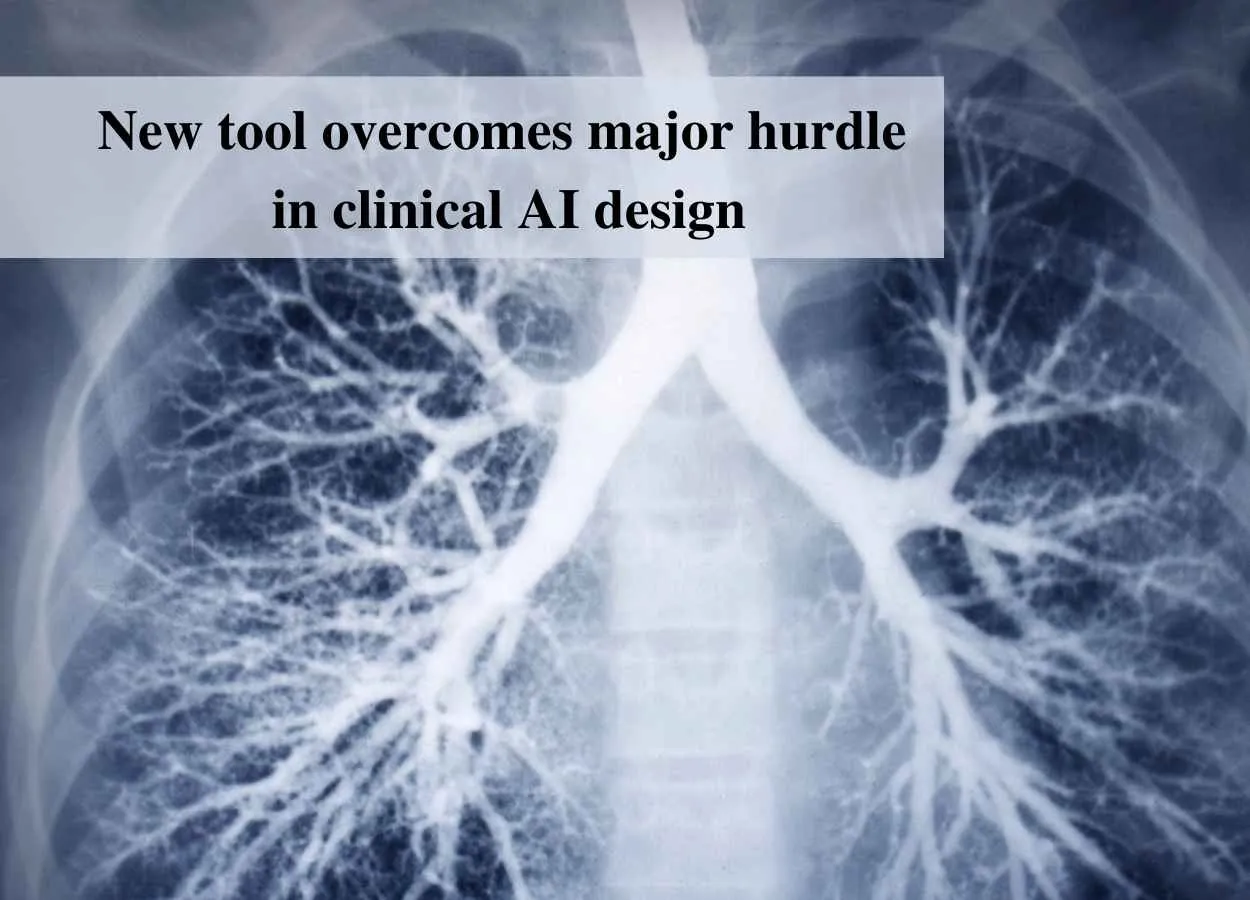 New tool overcomes major hurdle in clinical AI design