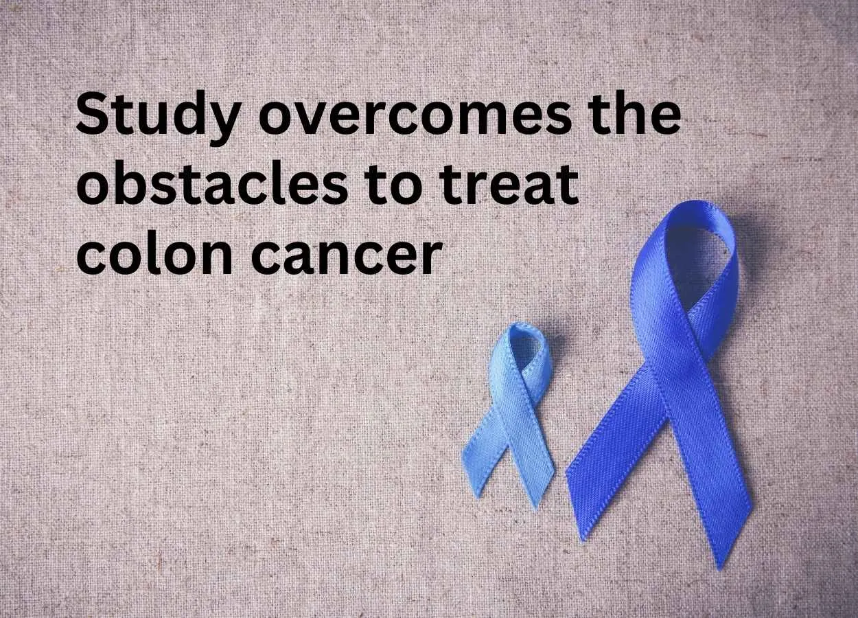 Study overcomes the obstacles to treatment for colon cancer