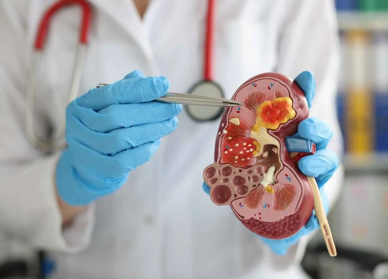 Dapagliflozin cost effective treatment for CKD