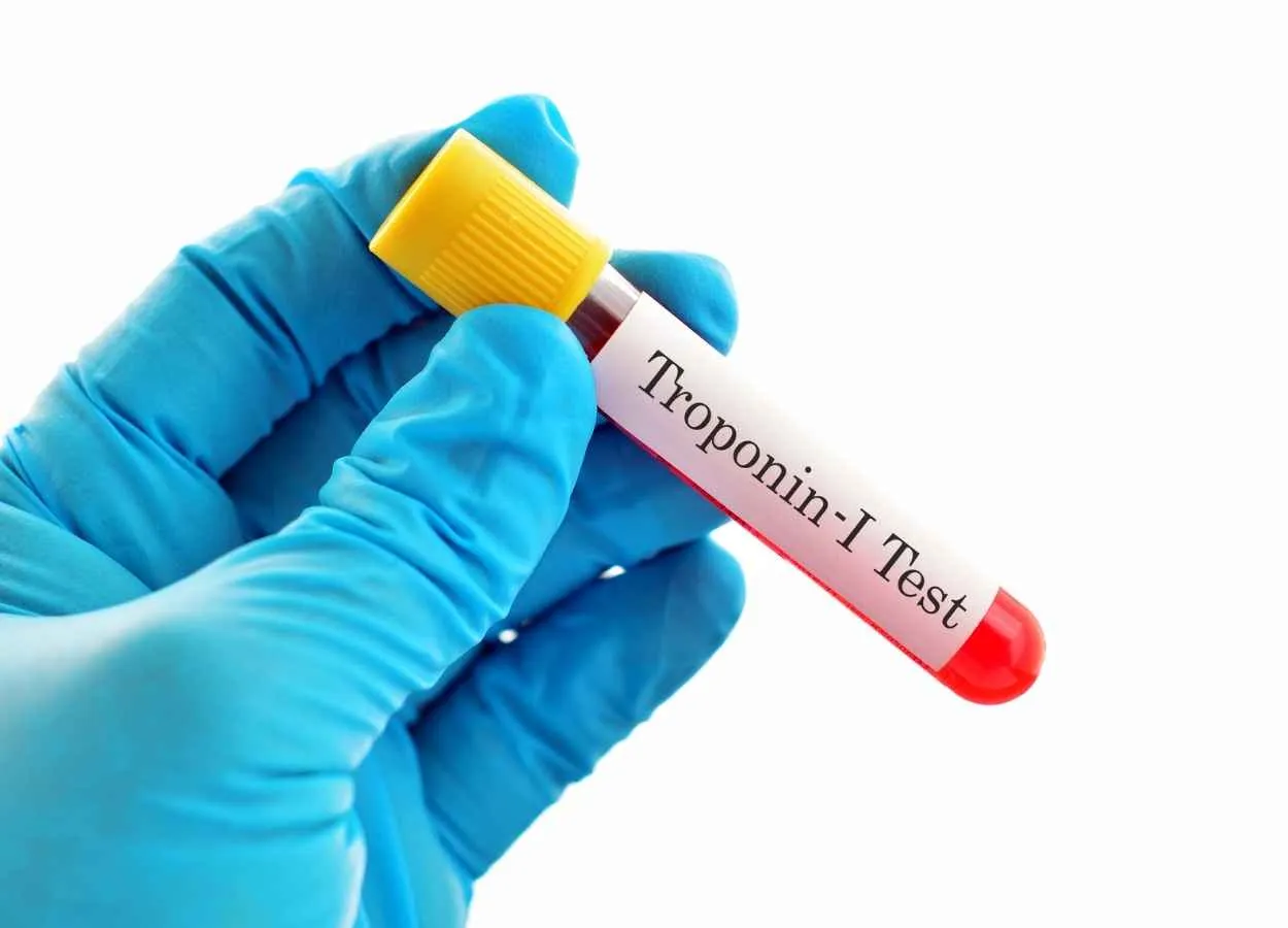 New troponin test improves heart attack diagnostics
