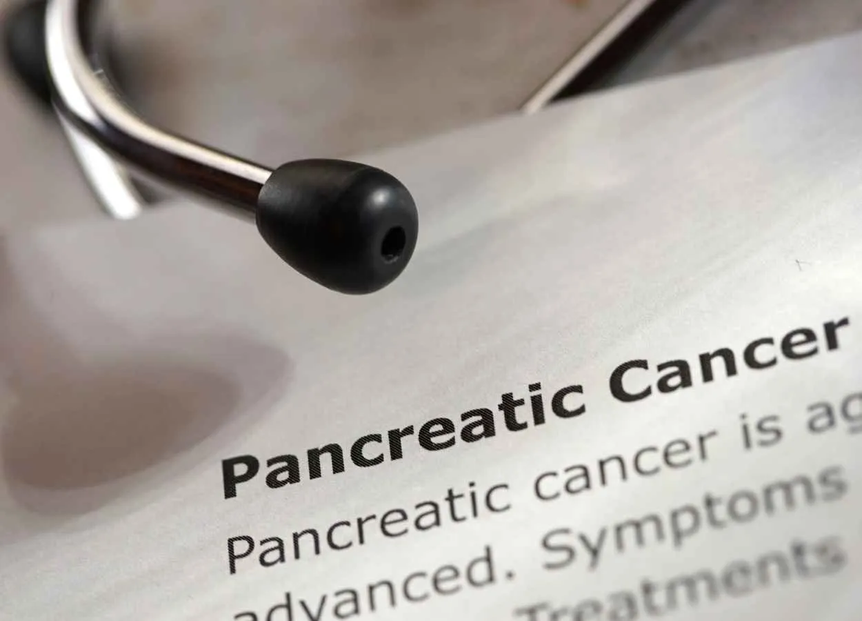 Weight loss and blood glucose are early indicators of pancreatic cancer