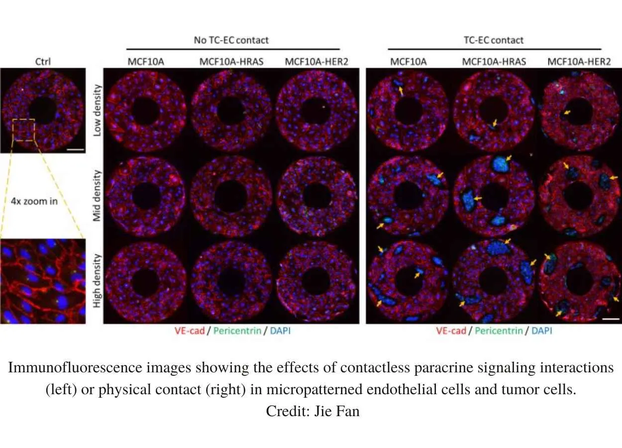 How Metastatic Cancer Causes Leaky Blood Vessels