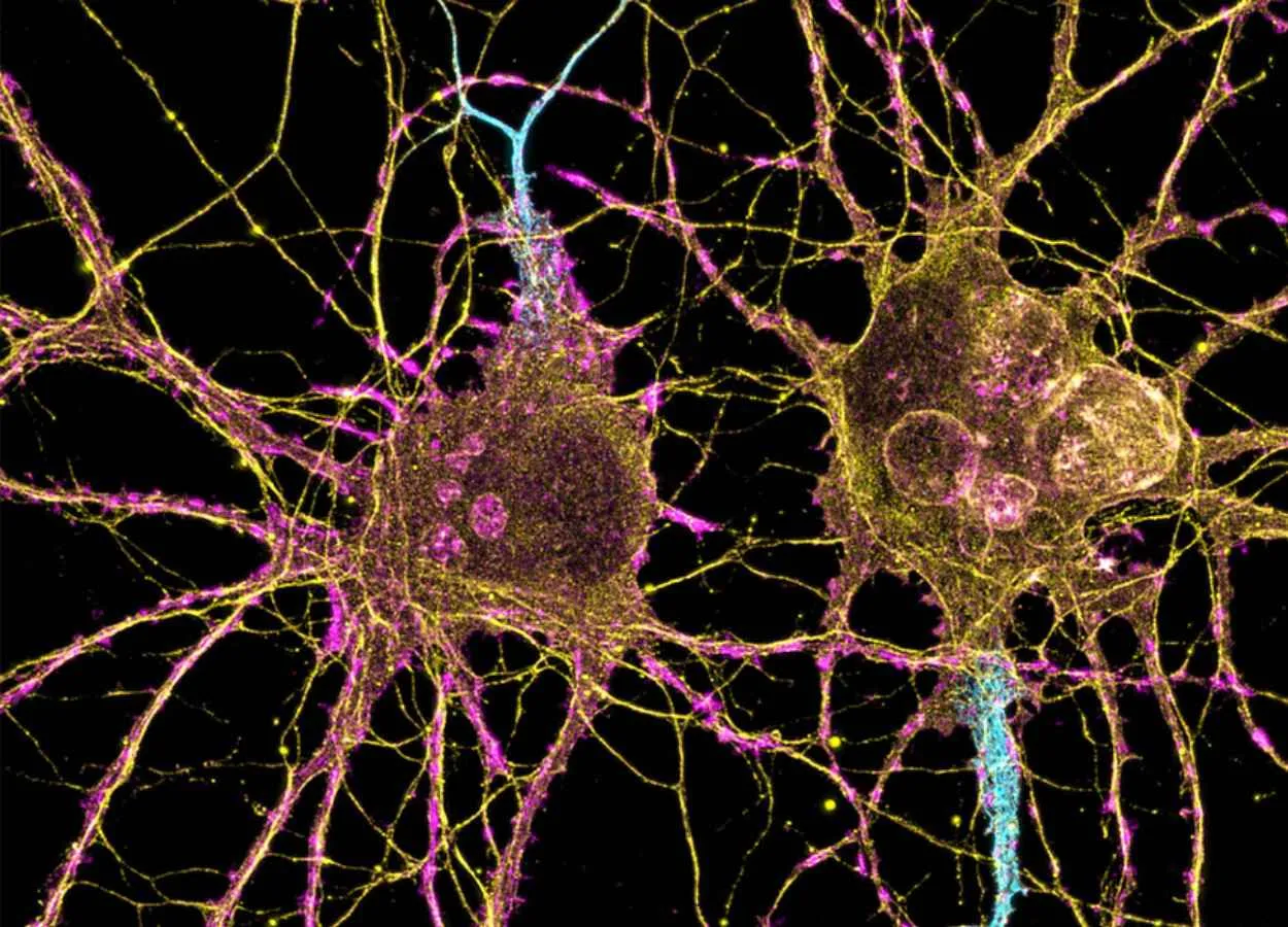 How Huntingtons disease affects different neurons