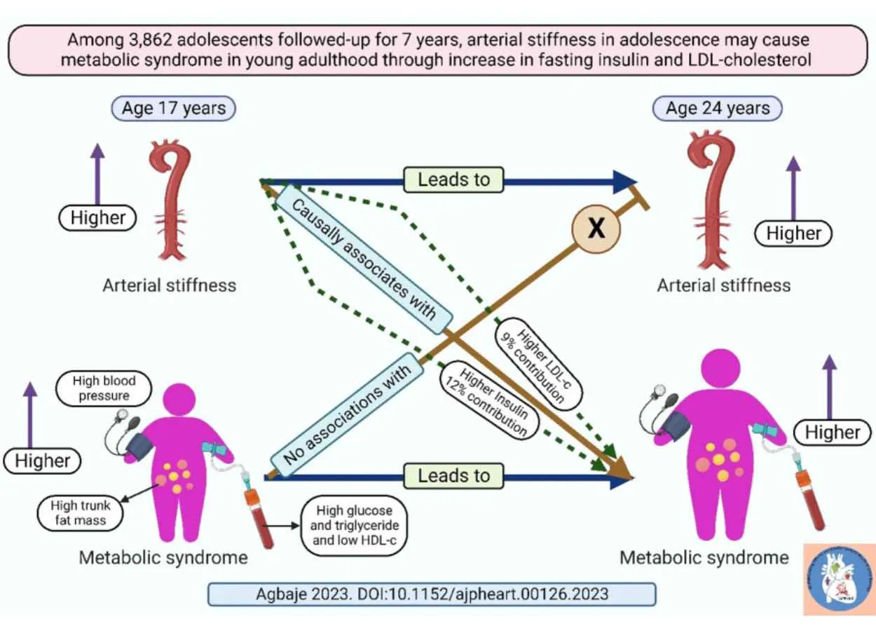 Arterial stiffness may cause metabolic syndrome in adolescents via an increase in fasting insulin and LDL-​cholesterol