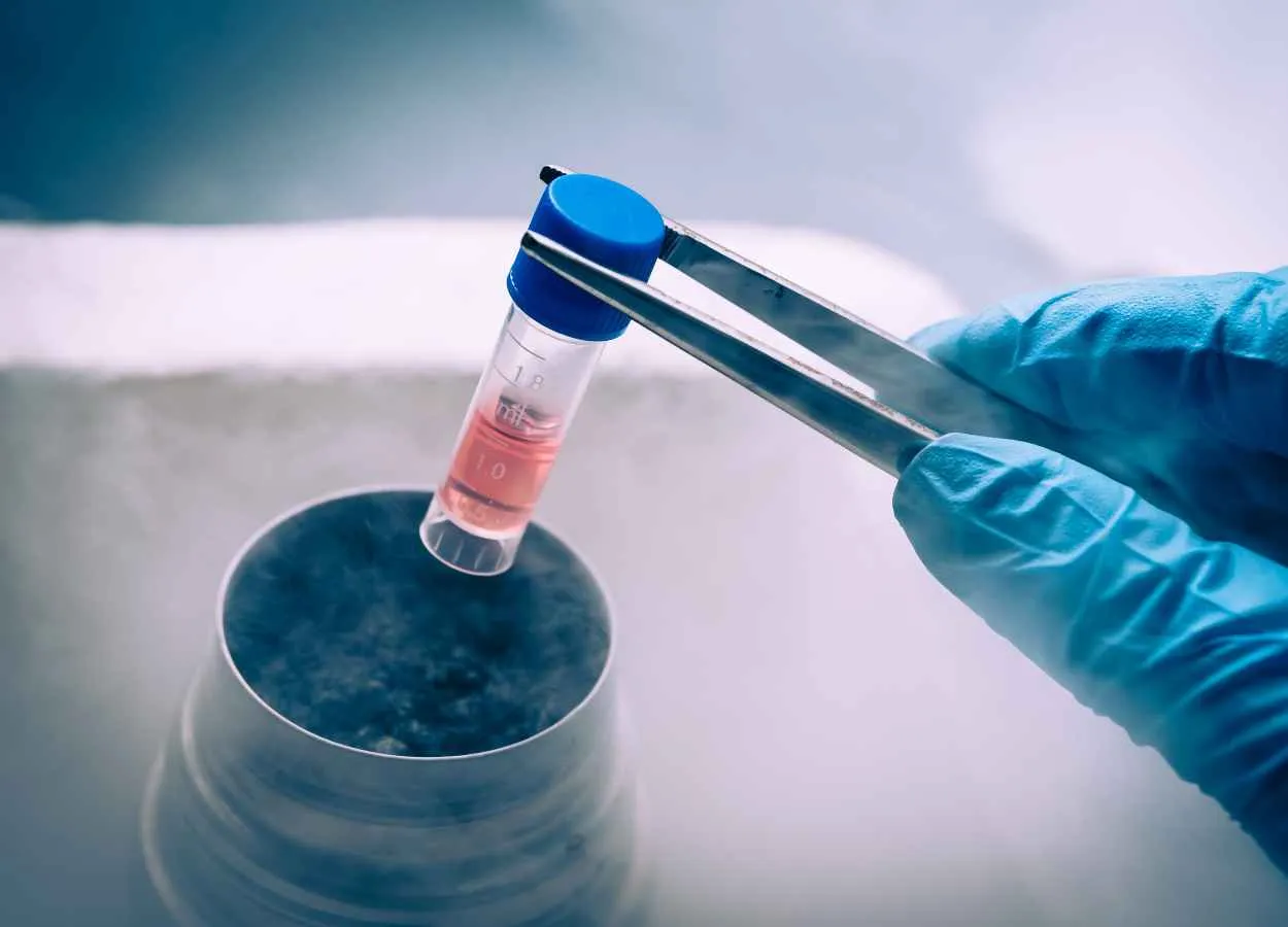 Stem cell transplantation can kill HIV, suggests research