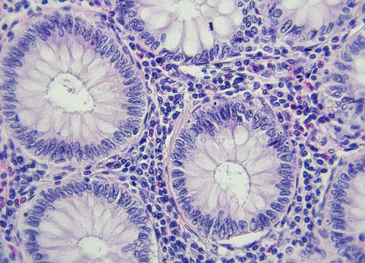 Blocking proteins could pull the plug on power for colon tumors