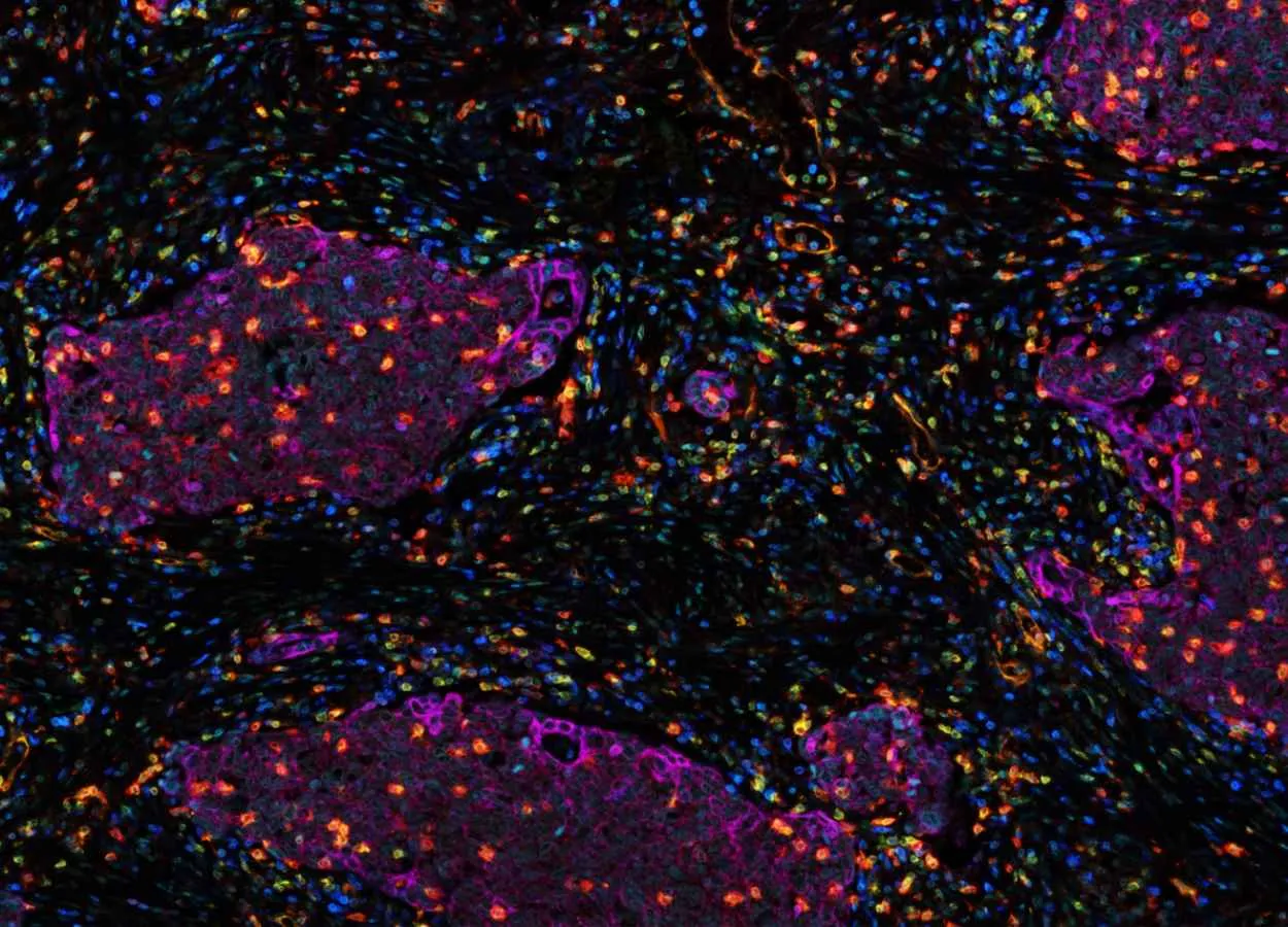 Blood cell insights could boost lung cancer therapies