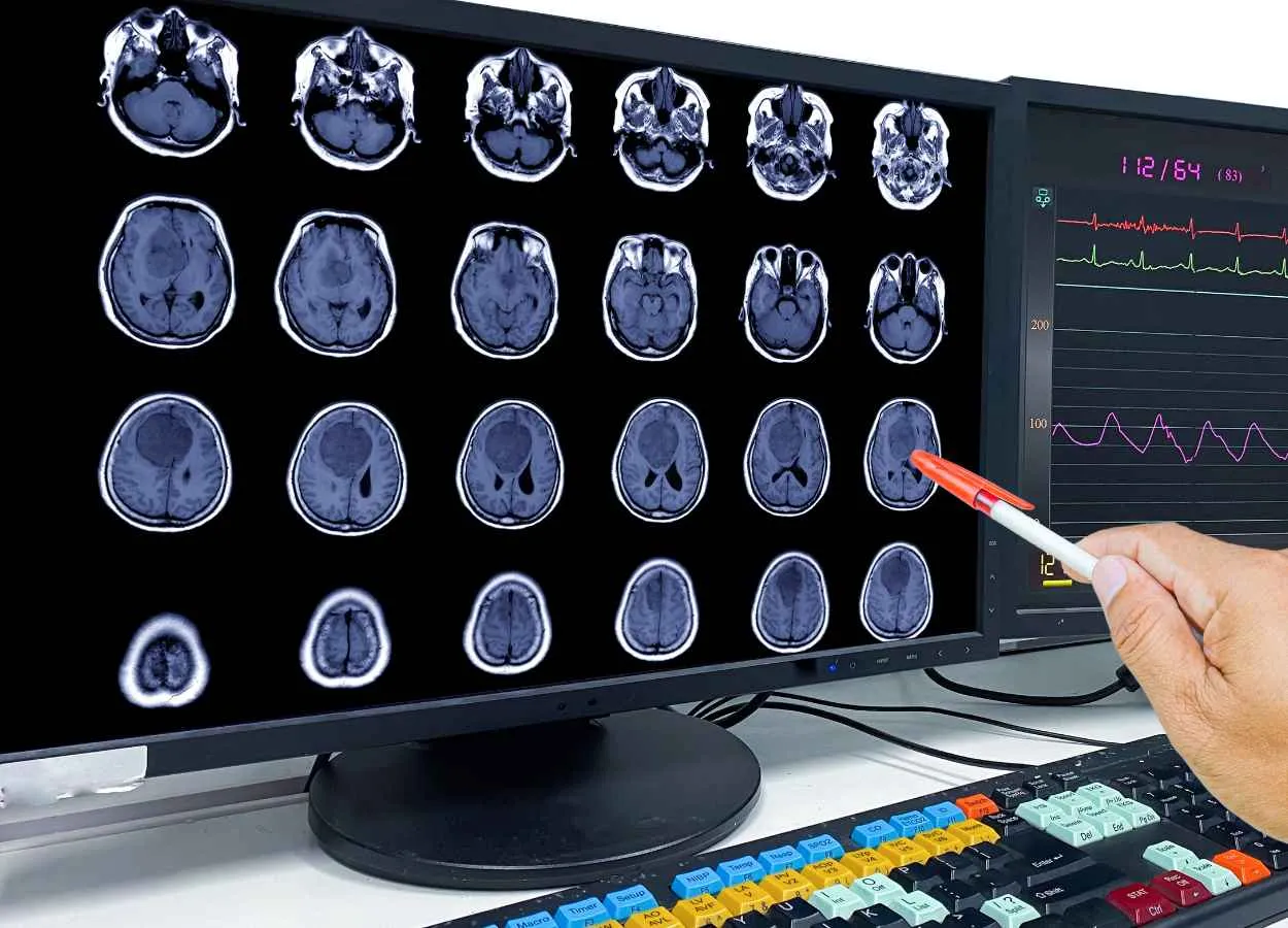 Dana-Farber Leads Adaptive, Efficient Multi-arm Phase 2 Clinical Trial for Glioblastoma