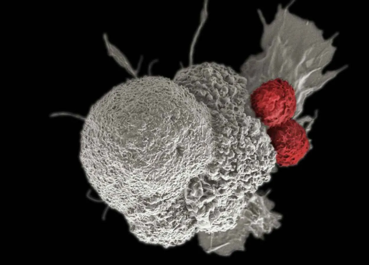 Cancer Drug Restores Immune System’s Ability to Fight Tumors