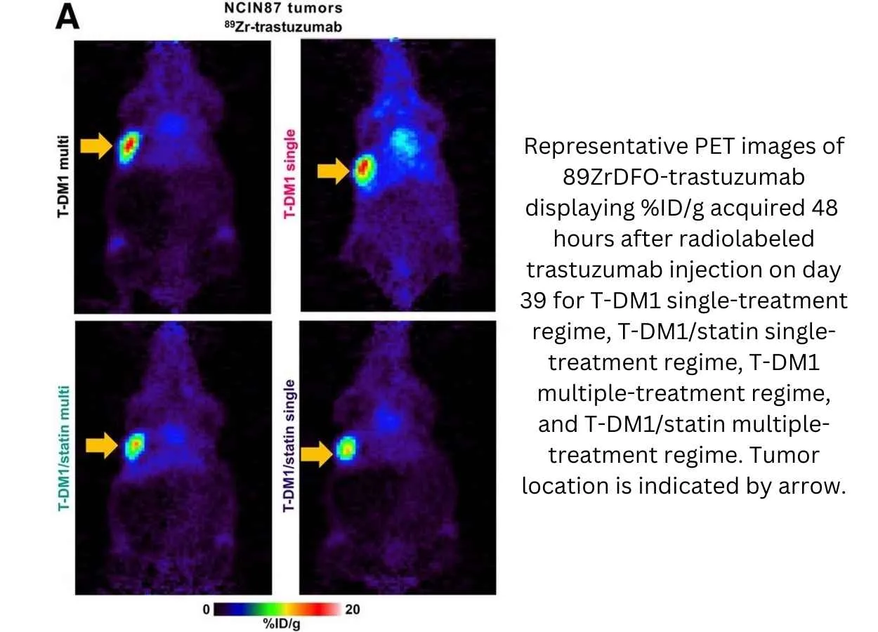 PET Imaging Validates use of Common Cholesterol Drug to Enhance HER2-Targeted Cancer Therapy