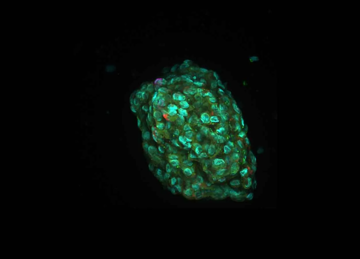Personalized cancer medicine
