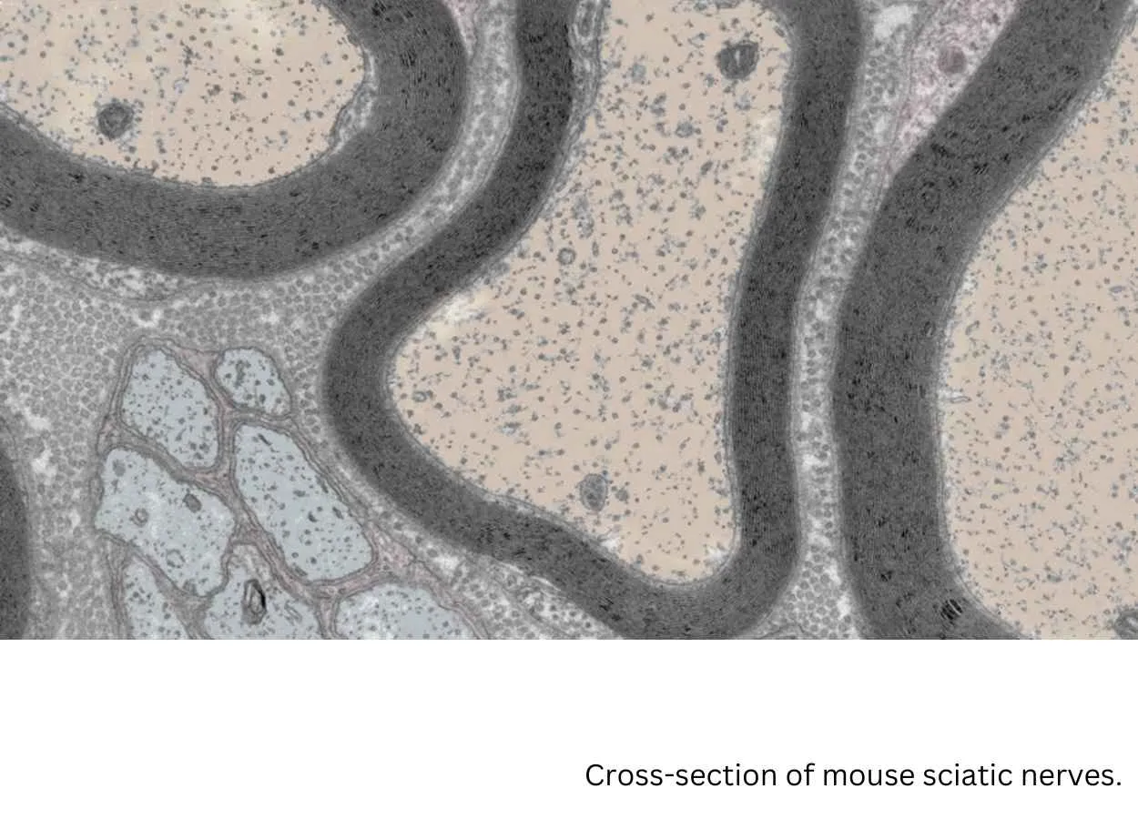 Repairing nerve cells after injury and in chronic disease