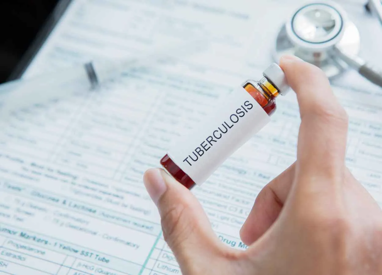 Researchers Develop a New Model by Leveraging an Old Vaccine to Build Better Tuberculosis Vaccines