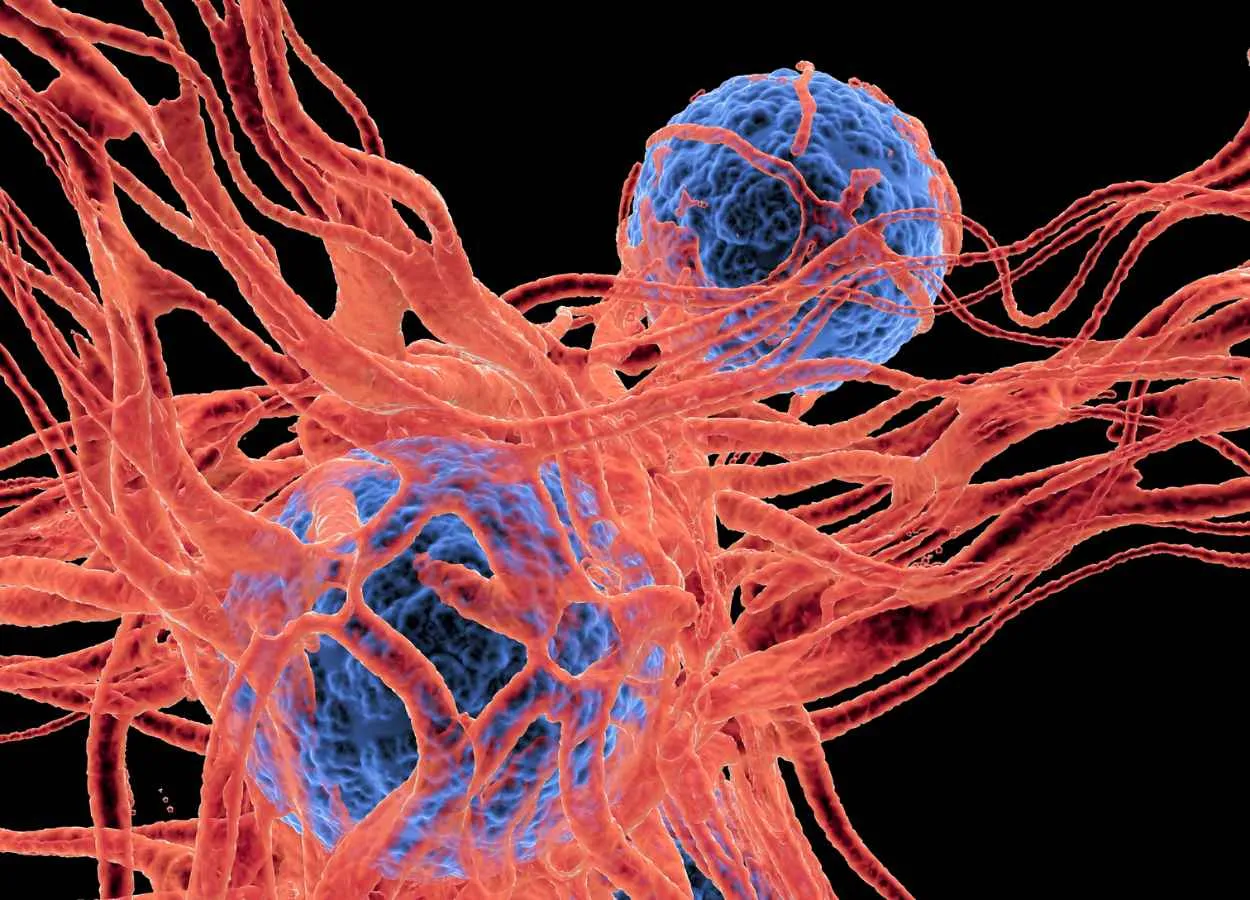 Researchers Identify Cell Signaling Pathway Controlling Melanoma Cell Metastasis to the Brain 