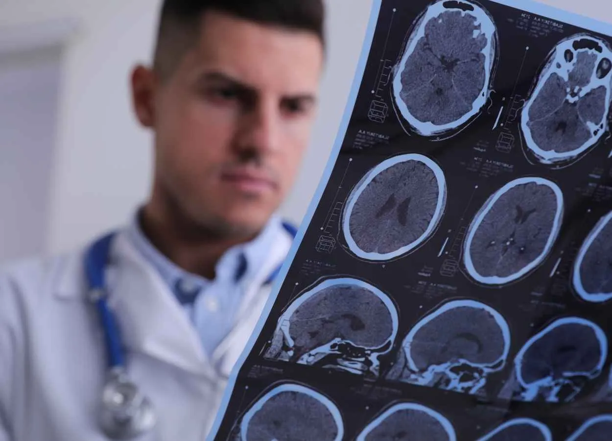 CAMH develops potential new drug treatment for multiple sclerosis