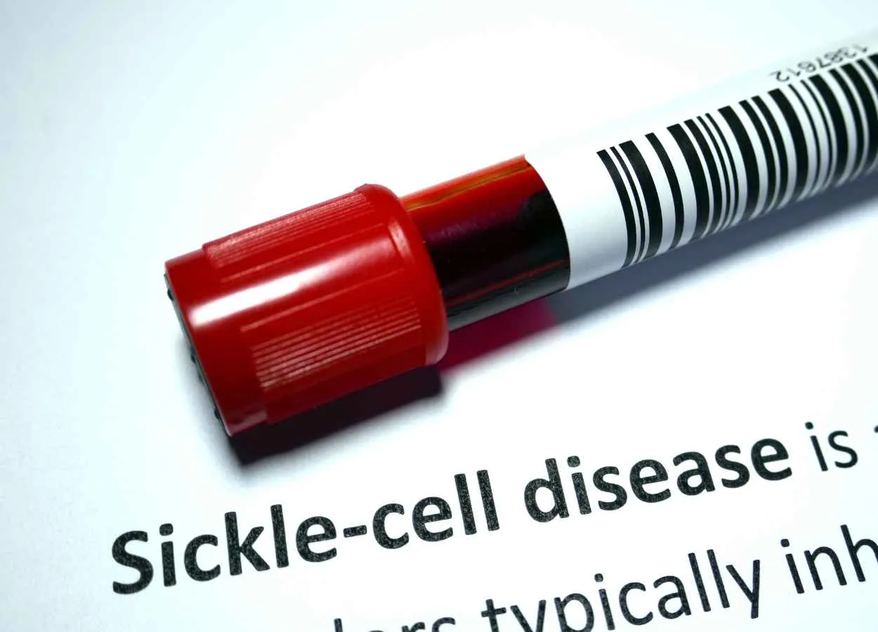 FDA approves first Gene Therapies to Treat Patients with Sickle Cell Disease