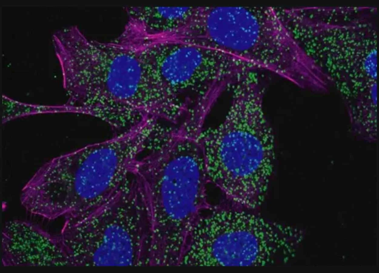 Leukemia cells activate cellular recycling program