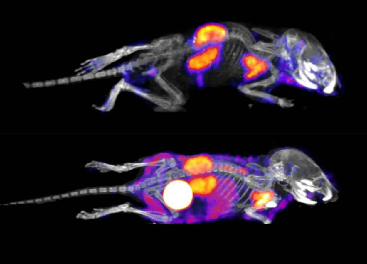 mRNA technology could be possible treatment for rare diseases