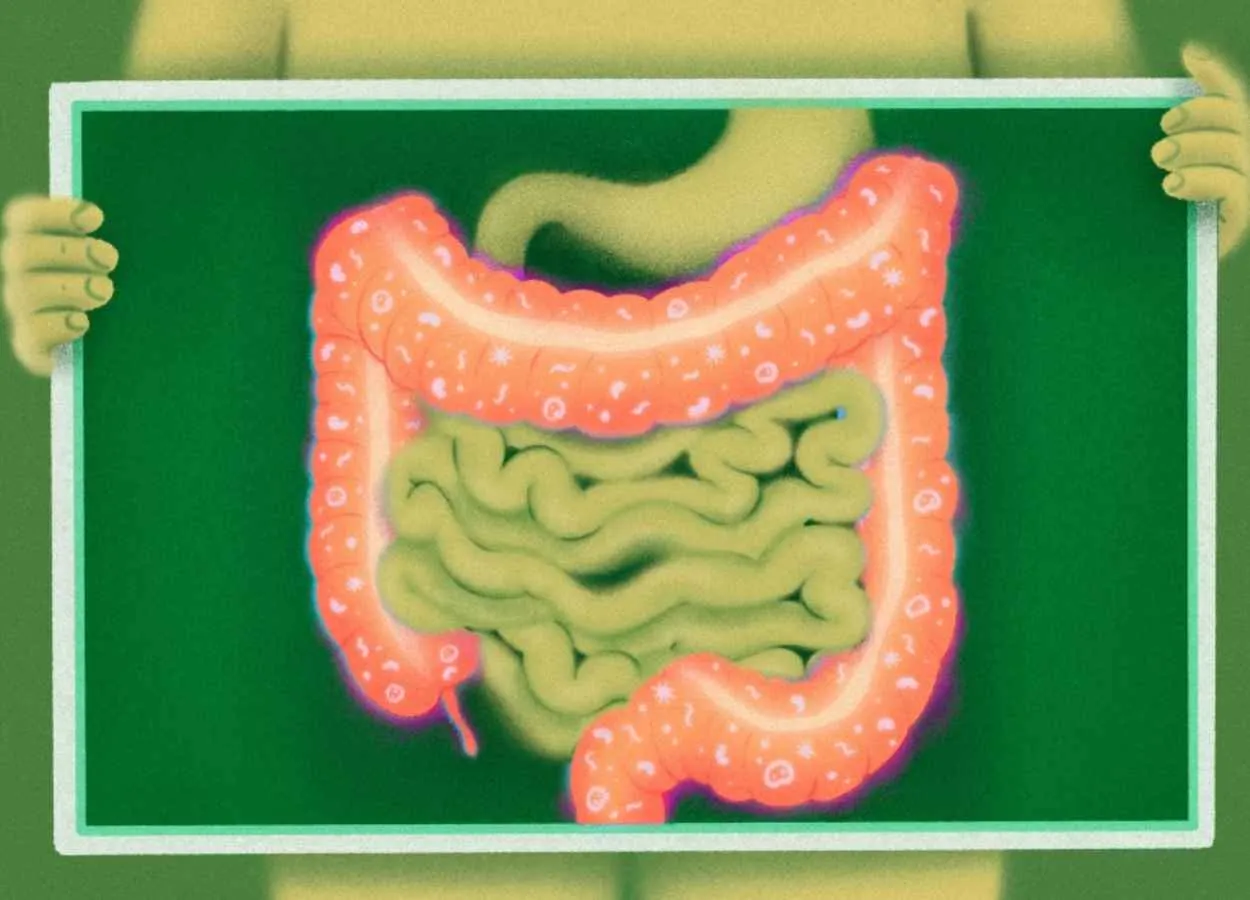 Researchers identify why cancer immunotherapy can cause colitis