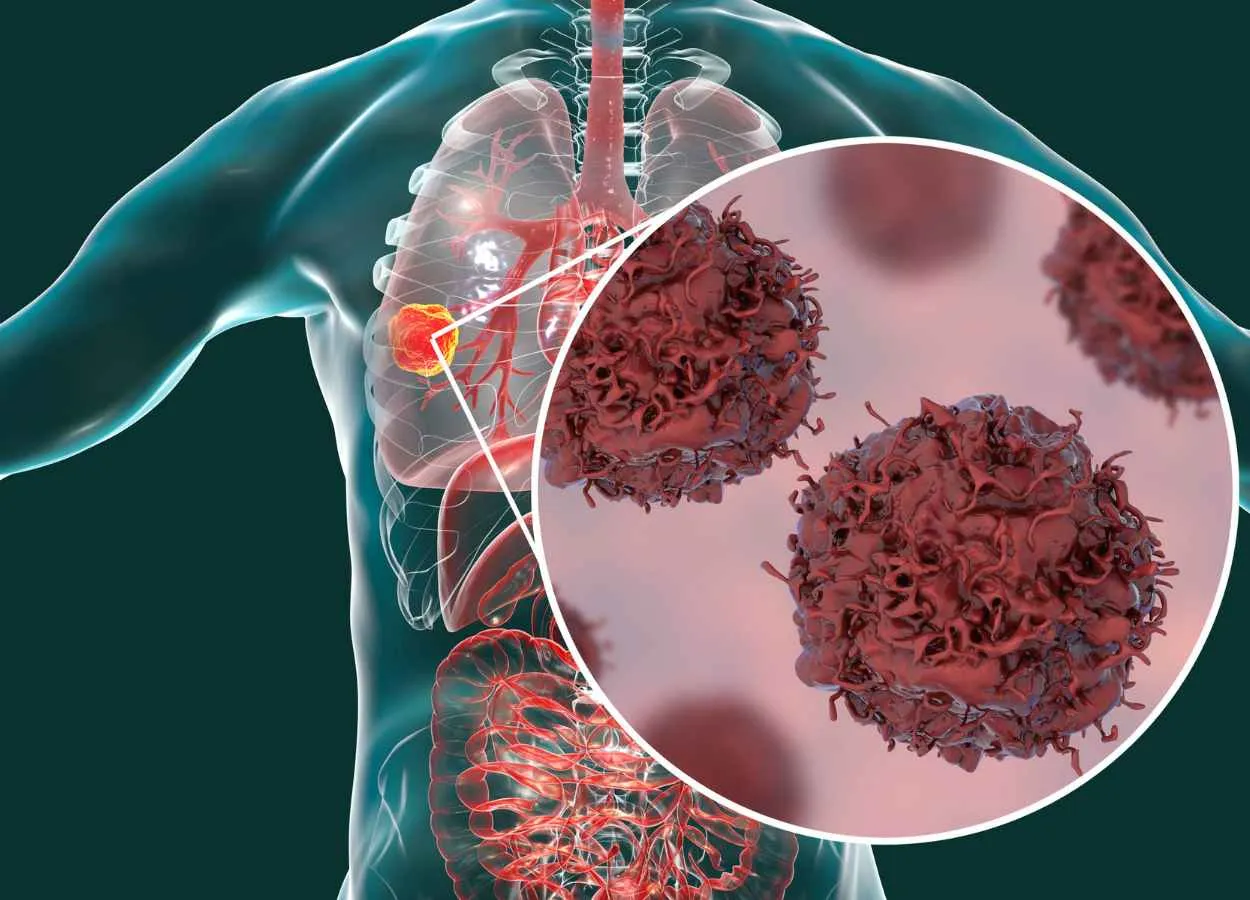 Bayer receives U.S. FDA Breakthrough Therapy designation for BAY 2927088 for non-small cell lung cancer