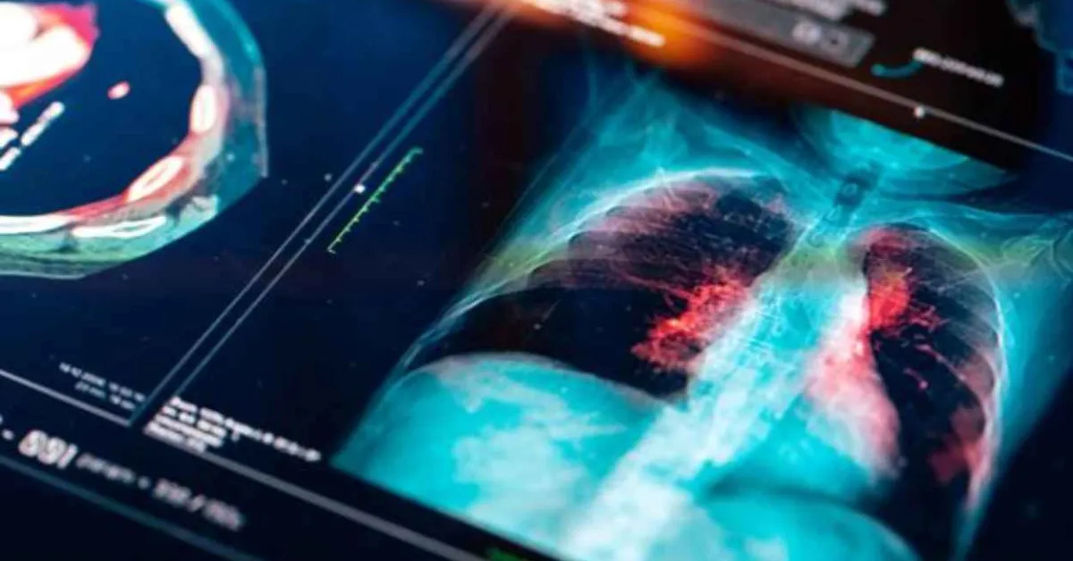 New treatment for a rare and aggressive cancer improves survival rates in breakthrough clinical trial 