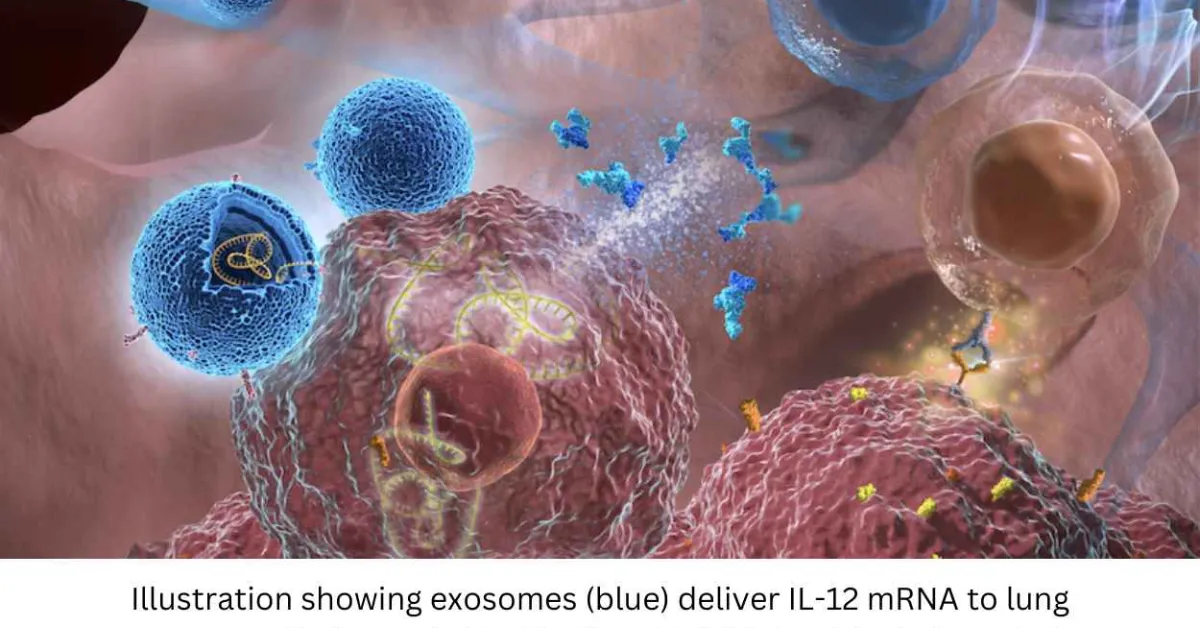 Study Finds New Inhalable Therapy is a Big Step Forward in Lung Cancer Research 