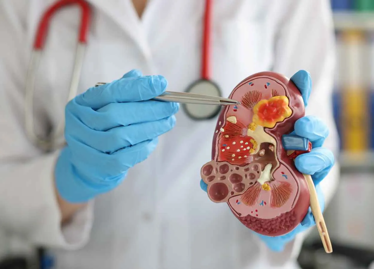 Novo Nordisk announced results from the kidney outcomes trial FLOW