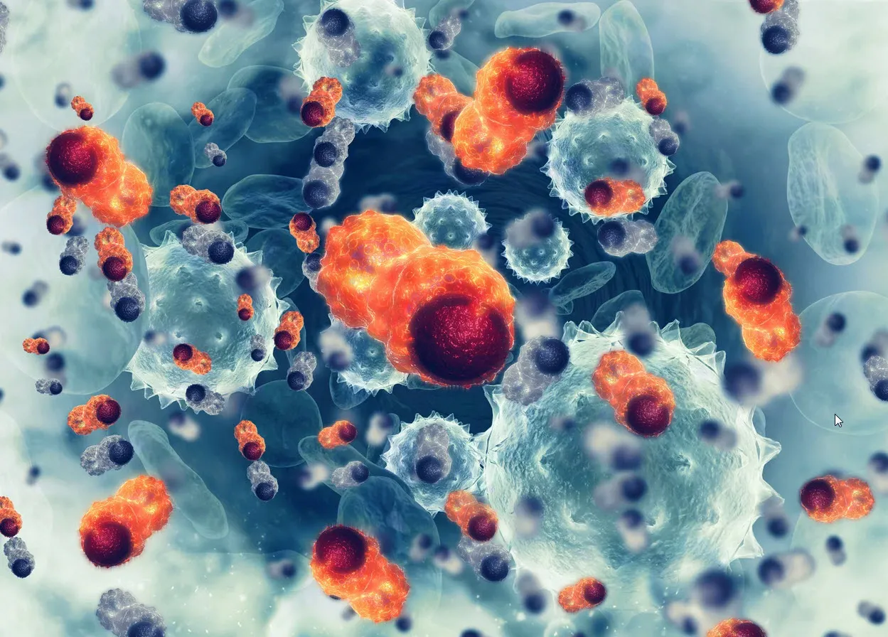 CAR T cell therapy targeting HER2 antigen shows promise against advanced sarcoma in phase I trial