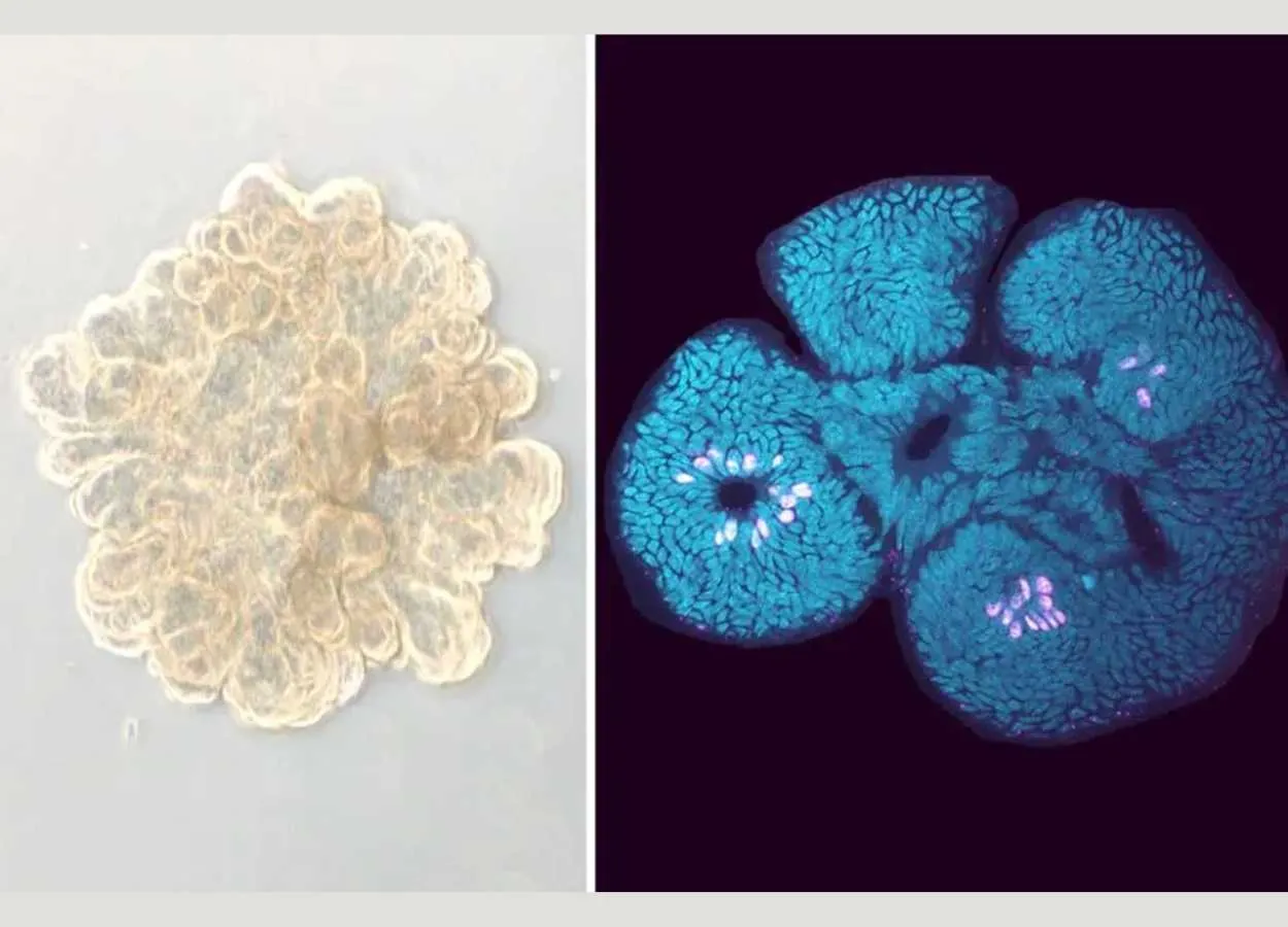 New study demonstrates the efficacy of a promising celiac disease drug at the molecular level