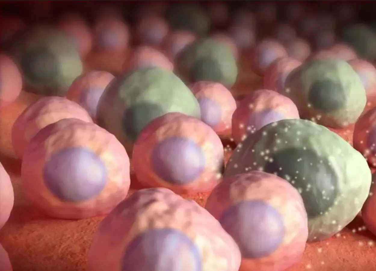 Drugs that kill zombie cells may benefit some older women, but not all, Mayo Clinic study finds