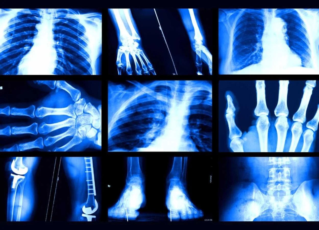 Study reveals why AI models that analyze medical images can be biased