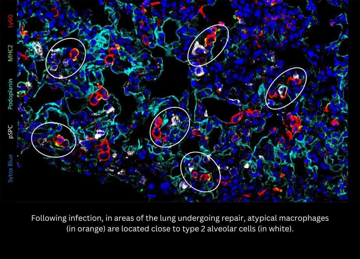 Discovery of a new population of macrophages promoting lung repair after viral infections