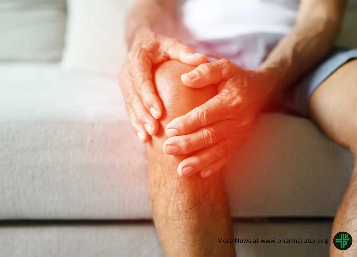 Sun Pharma and Moebius Medical Announce Fast Track Designation Granted for MM-II for the Treatment of Osteoarthritis Knee Pain