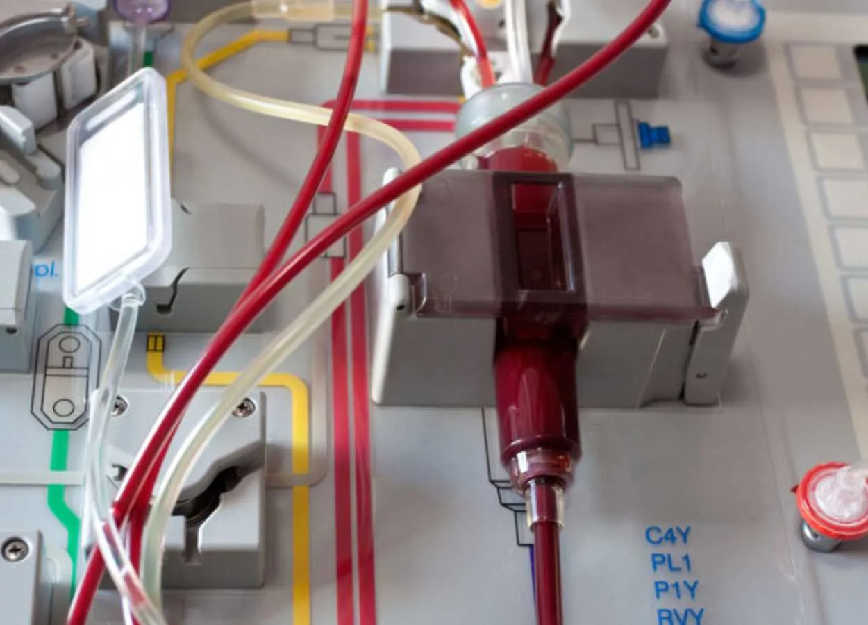 New drug tested to reduce side effect of ‘half-matched’ stem cell transplants