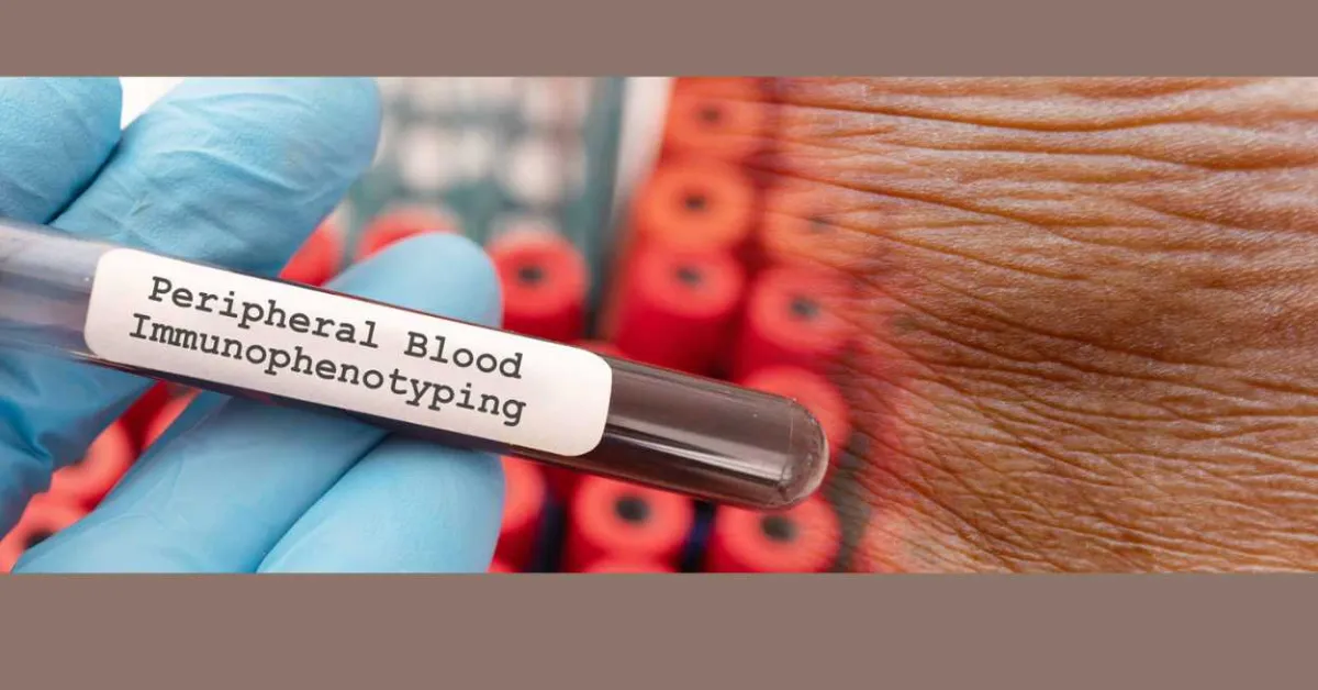 UM School of Medicine Dermatology Researchers Discover New Skin Disease Using Innovative Diagnostic Platform