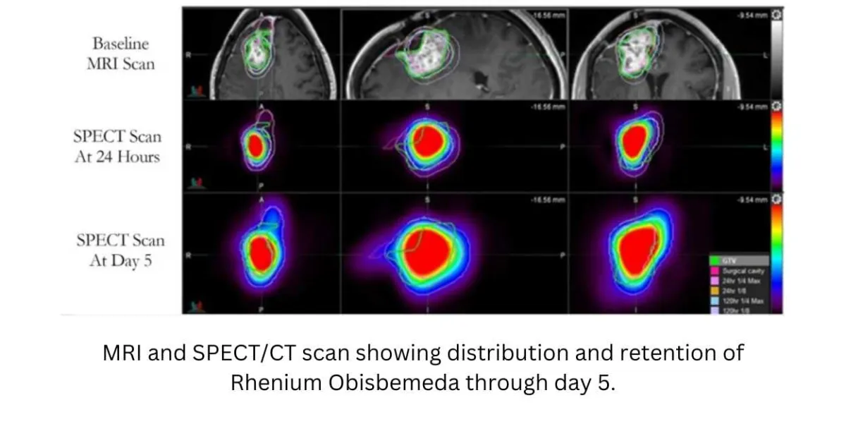 UT Health San Antonio develops drug found to more than double survival time for glioblastoma patients