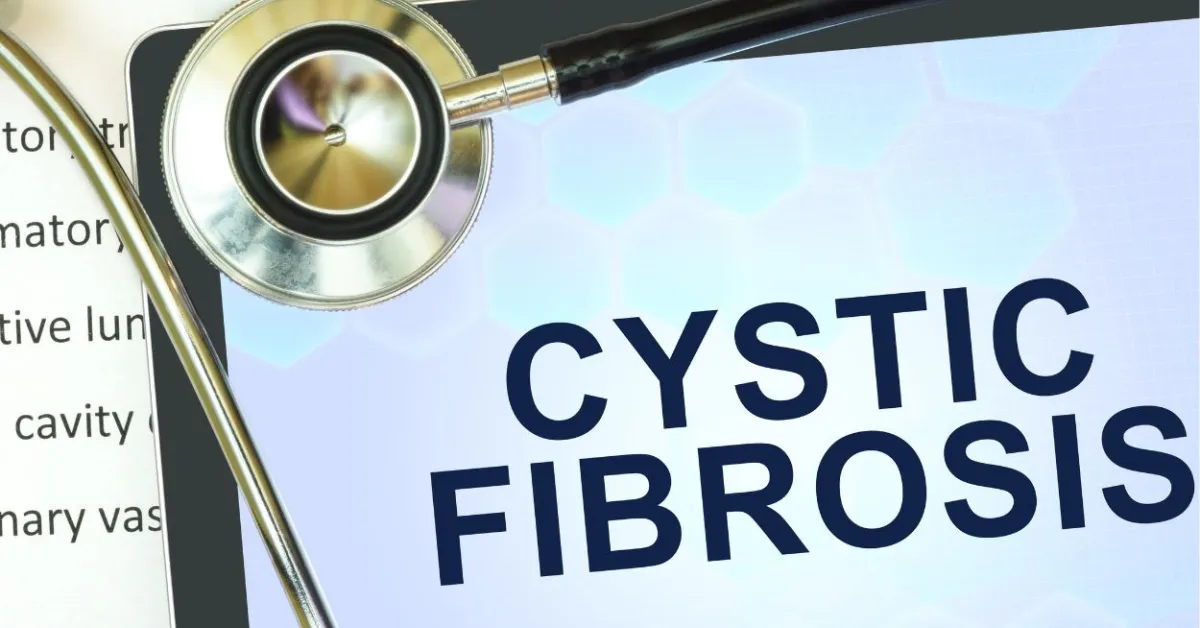 First guideline on newborn screening for cystic fibrosis calls for changes in practice to improve outcomes