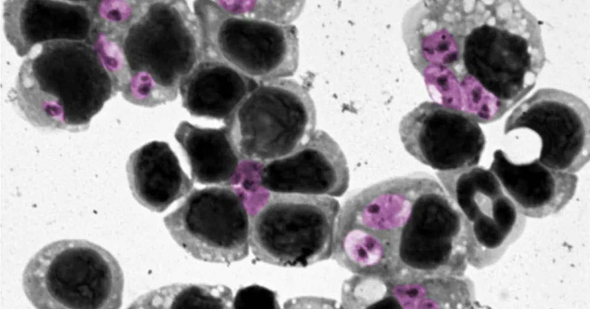 Researchers Discover Way to Predict Treatment Success for Parasitic Skin Disease
