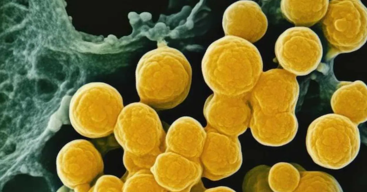 Tulane researchers use AI to improve diagnosis of drug-resistant infections