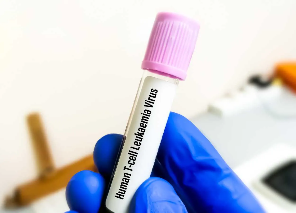 WHO announces the development of new recommendations on HTLV-1